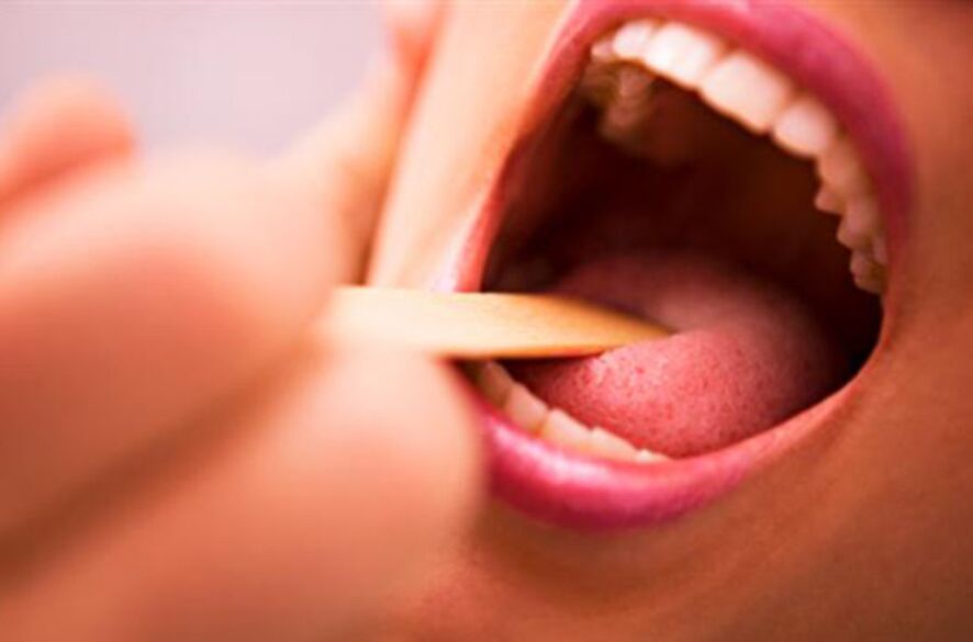 адамдын оозундагы мителердин түрлөрү